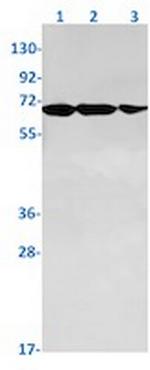 Phospho-PAK1/PAK2/PAK3 (Ser144, Ser141, Ser154) Antibody in Western Blot (WB)