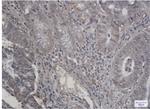 RPS6KB2 Recombinant Rabbit Monoclonal Antibody