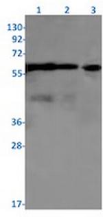 RPS6KB2 Antibody in Western Blot (WB)