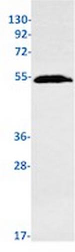 TP53 Antibody in Western Blot (WB)