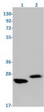 CDKN1B Antibody in Western Blot (WB)