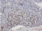 CDKN2C Recombinant Rabbit Monoclonal Antibody
