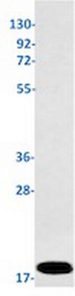 CDKN2C Antibody in Western Blot (WB)