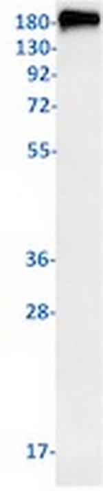 ABCB1 Recombinant Rabbit Monoclonal Antibody