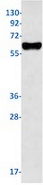 NR4A1 Recombinant Rabbit Monoclonal Antibody
