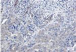 NUMB Recombinant Rabbit Monoclonal Antibody