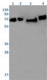 NUMB Antibody in Western Blot (WB)
