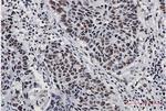 NPM1 Antibody in Immunohistochemistry (Paraffin) (IHC (P))