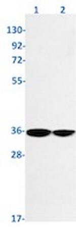 NTHL1 Antibody in Western Blot (WB)