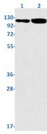 NOTCH1 Recombinant Rabbit Monoclonal Antibody