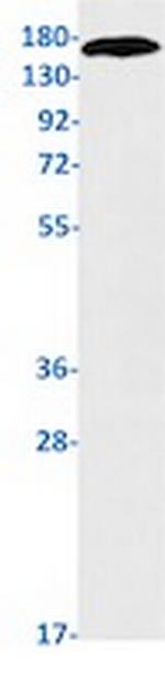 SLC12A1 Recombinant Rabbit Monoclonal Antibody
