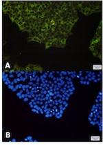 NFKB2 Recombinant Rabbit Monoclonal Antibody