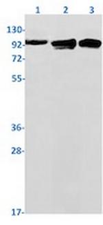 NFKB2 Antibody in Western Blot (WB)