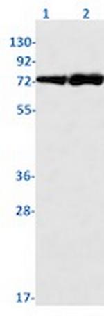 NF2 Antibody in Western Blot (WB)