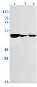 TACR1 Recombinant Rabbit Monoclonal Antibody
