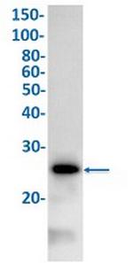 MPZ Recombinant Rabbit Monoclonal Antibody