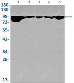 MRE11 Antibody in Western Blot (WB)