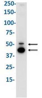 MMP12 Recombinant Rabbit Monoclonal Antibody
