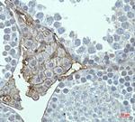 GRM2 Recombinant Rabbit Monoclonal Antibody