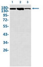 MET Antibody in Western Blot (WB)