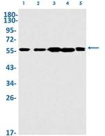 MEF2A Antibody in Western Blot (WB)