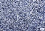 MBD2 Recombinant Rabbit Monoclonal Antibody