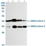 MBD2 Antibody in Western Blot (WB)