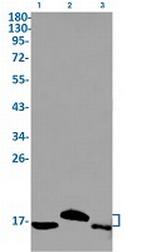 MAP1LC3A Antibody in Western Blot (WB)
