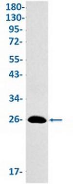 MAD2L2 Antibody in Western Blot (WB)