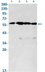 LUM Antibody in Western Blot (WB)