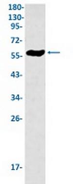 LCK Antibody in Western Blot (WB)