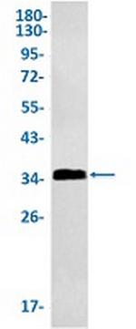 LAT Antibody in Western Blot (WB)