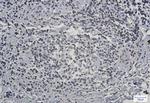 LBR Recombinant Rabbit Monoclonal Antibody