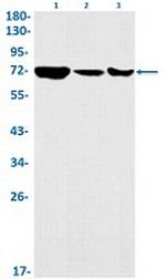 KIFC1 Antibody in Western Blot (WB)
