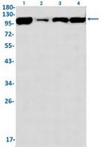TRIM28 Antibody in Western Blot (WB)