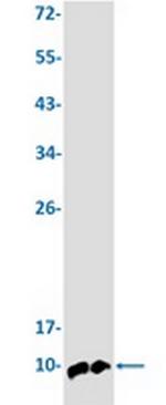 UBB Antibody in Western Blot (WB)