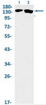 JARID2 Recombinant Rabbit Monoclonal Antibody