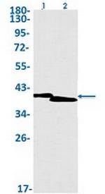 ISL1 Recombinant Rabbit Monoclonal Antibody