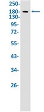 IQGAP2 Recombinant Rabbit Monoclonal Antibody