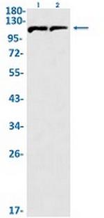 IFNAR1 Recombinant Rabbit Monoclonal Antibody