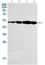 INHBA Recombinant Rabbit Monoclonal Antibody