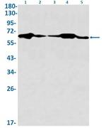 IGF2BP3 Antibody in Western Blot (WB)