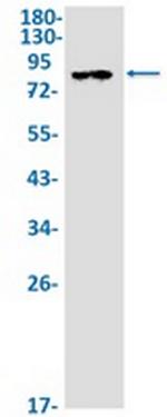 IKBKB Antibody in Western Blot (WB)