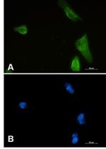 IKBKB Recombinant Rabbit Monoclonal Antibody