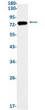 IKBKB Antibody in Western Blot (WB)