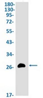 IGFBP1 Recombinant Rabbit Monoclonal Antibody