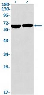IGF2BP1 Antibody in Western Blot (WB)