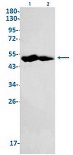 IDH2 Recombinant Rabbit Monoclonal Antibody