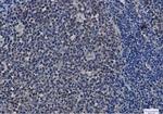 HSP90AA1/HSP90AB1 Recombinant Rabbit Monoclonal Antibody