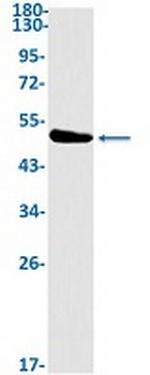 HOMER1 Recombinant Rabbit Monoclonal Antibody